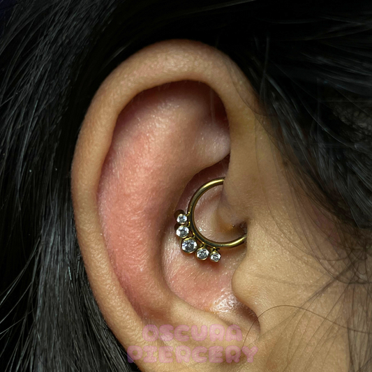 LOISA | Implant grade Titanium